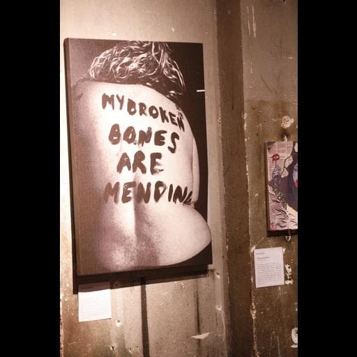Black-and-white print of bare back reading MY BROKEN BONES ARE MENDING.